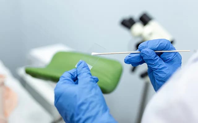 Smear Testi Nedir? Faydaları Nelerdir?